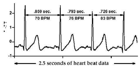 HRV R-R intervals