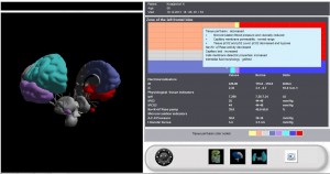 Central nervous system 