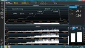 treadmill running